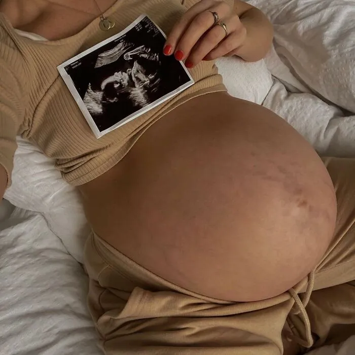 25 Madres comparten fotos realistas de sus barrigas y cuerpos de embarazada para luchar contra los estándares tóxicos