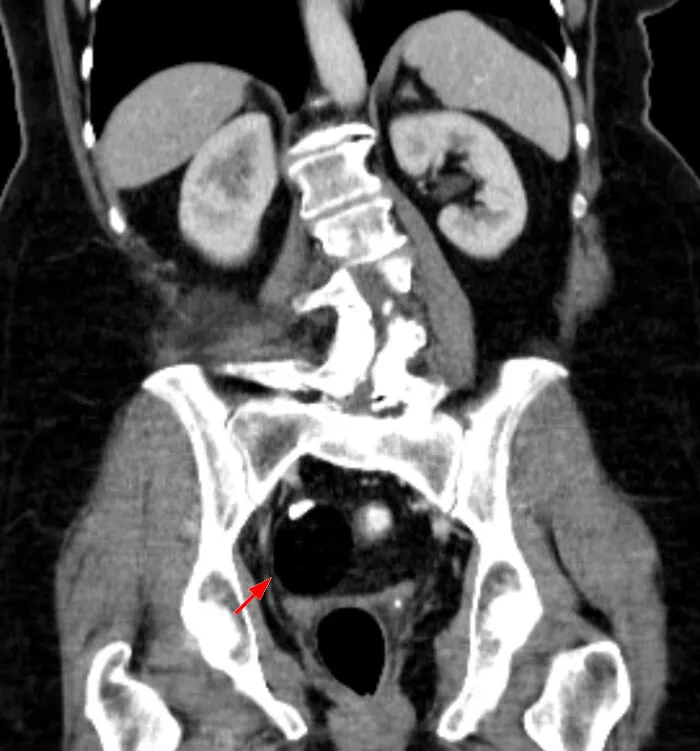 CT scan showing an abnormal mass inside the human body, highlighting one of the most disturbing things about human bodies.