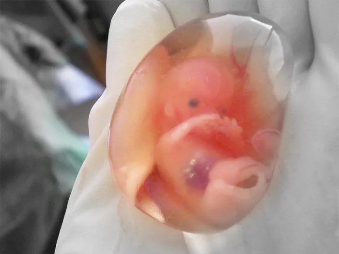 Fragile Beginnings