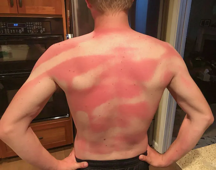My Wife Helped Me Sunscreen My Back At Beach Day Today. Twice