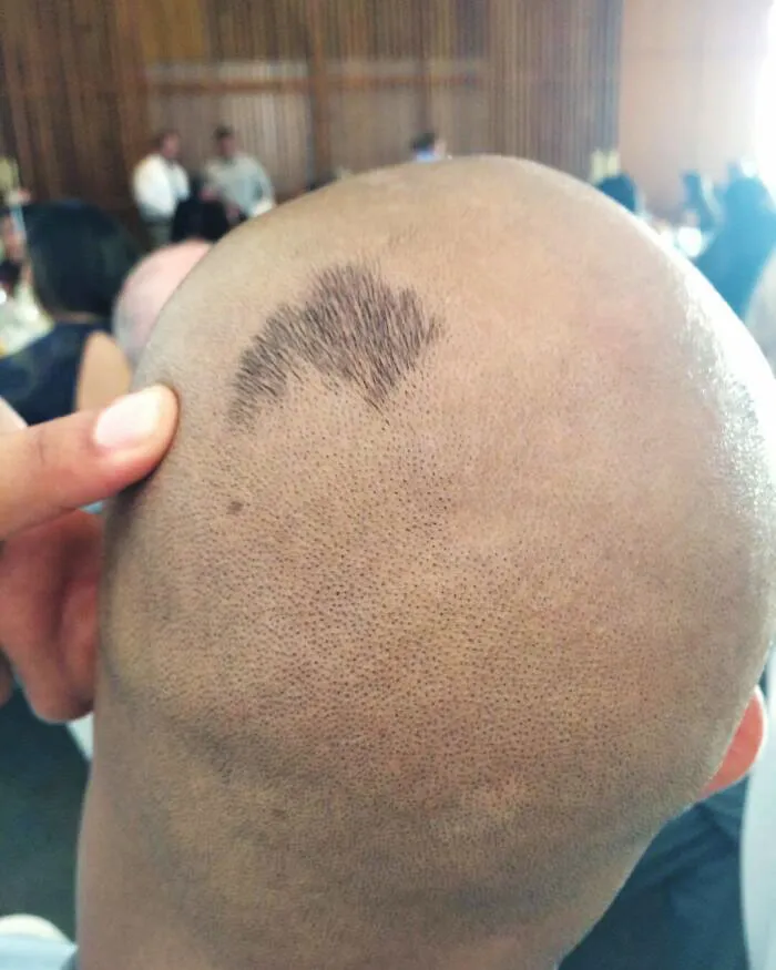 Me faltó un pequeño parche de pelo mientras afeitaba la parte trasera de la cabeza de Steven. No lo noté hasta la recepción de la boda de Tonya. Todo el mundo ya lo había visto
