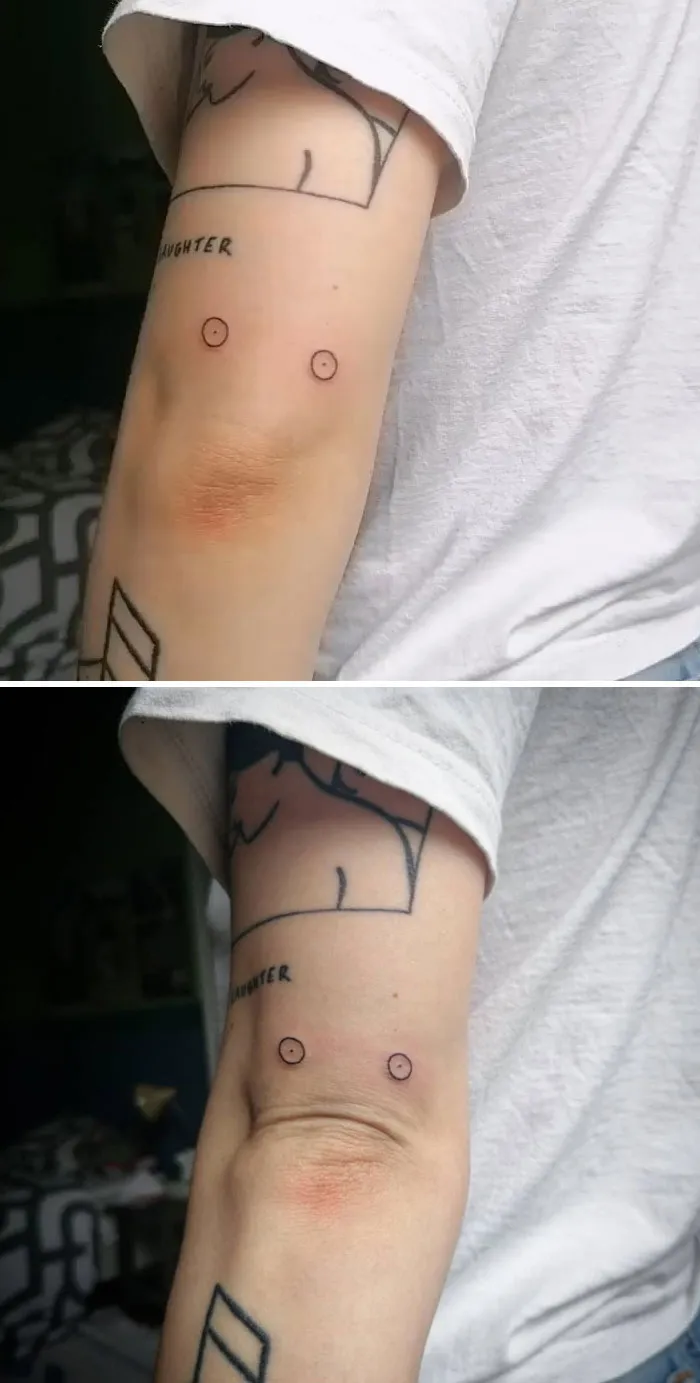 Sad Elbow Wrinkle