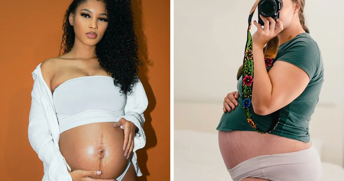 25 Madres comparten fotos realistas de sus barrigas y cuerpos de embarazada para luchar contra los estándares tóxicos
