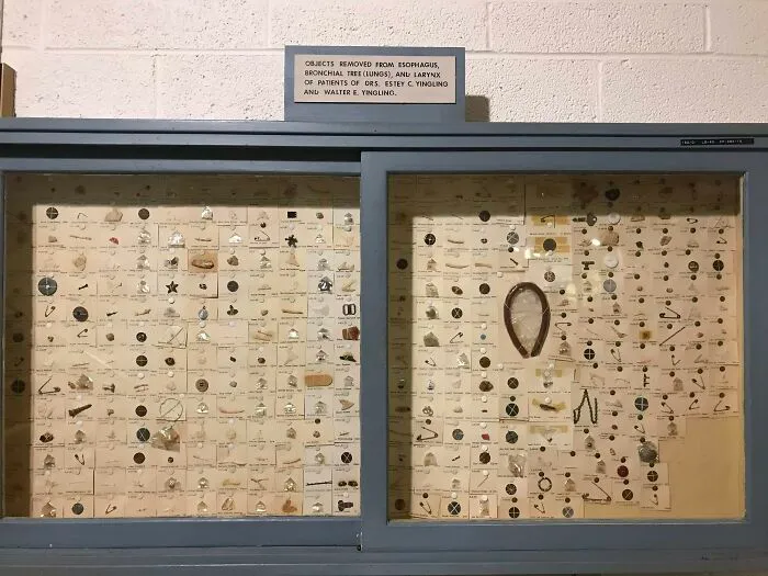 El museo de mi ciudad tiene una colección de objetos que los médicos han extraído de la garganta y los pulmones de los pacientes