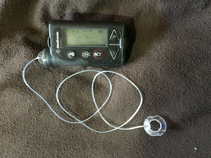 An Insulin Pump