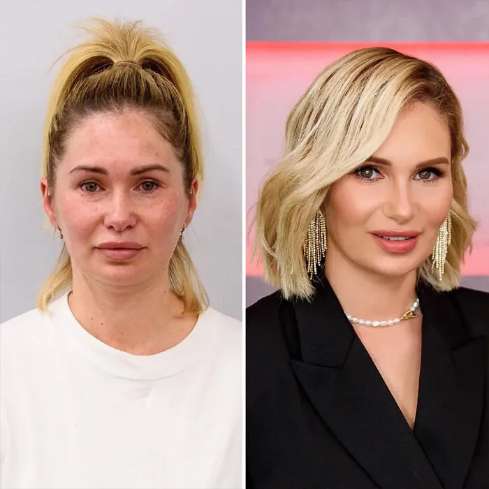 30 Transformations By This Hairstylist And His Team That Show The Power Of A Good Stylist (New Pics)