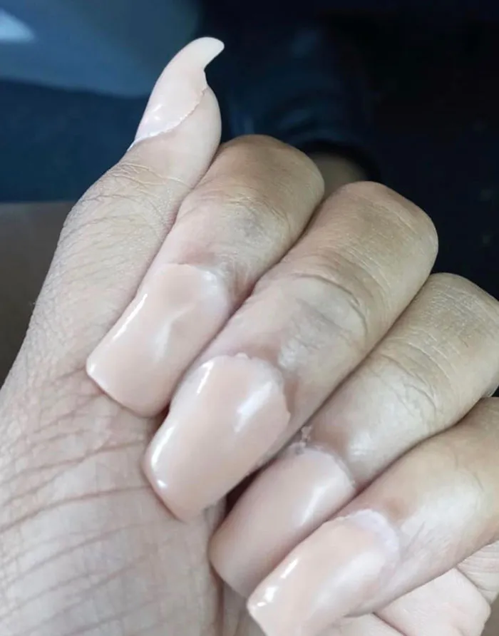 My Sister's Friend Got Her Nails Done By A “Professional” Nail Artist