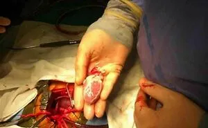 40 Bizarre And Inspiring Medical Cases That People Shared On This Online Community (New Pics)