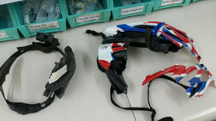 Cyclist Arrived In ED With This Helmet - Surprisingly Fine. Imagine His Skull Without A Helmet