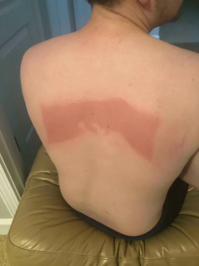 El protector solar es muy eficaz, pero no puedo llegar en medio de la espalda