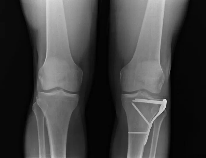 Why Would Urgent Care Need To Bother With An X-Ray Anyway...?