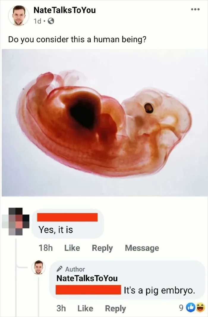 Do You Consider This A Human Being?