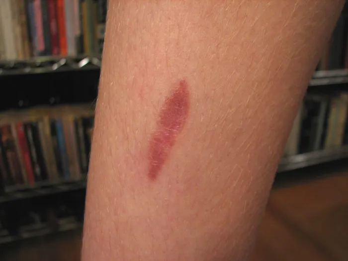 "48-Inch Scar"—Let That Sink In...