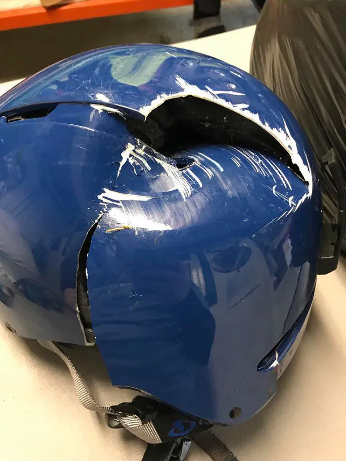 Here Is The Helmet Of A Guy Who Went Head-First Into The Base Of A Lift Tower And Walked Away With A Minor Concussion. Wear A Helmet