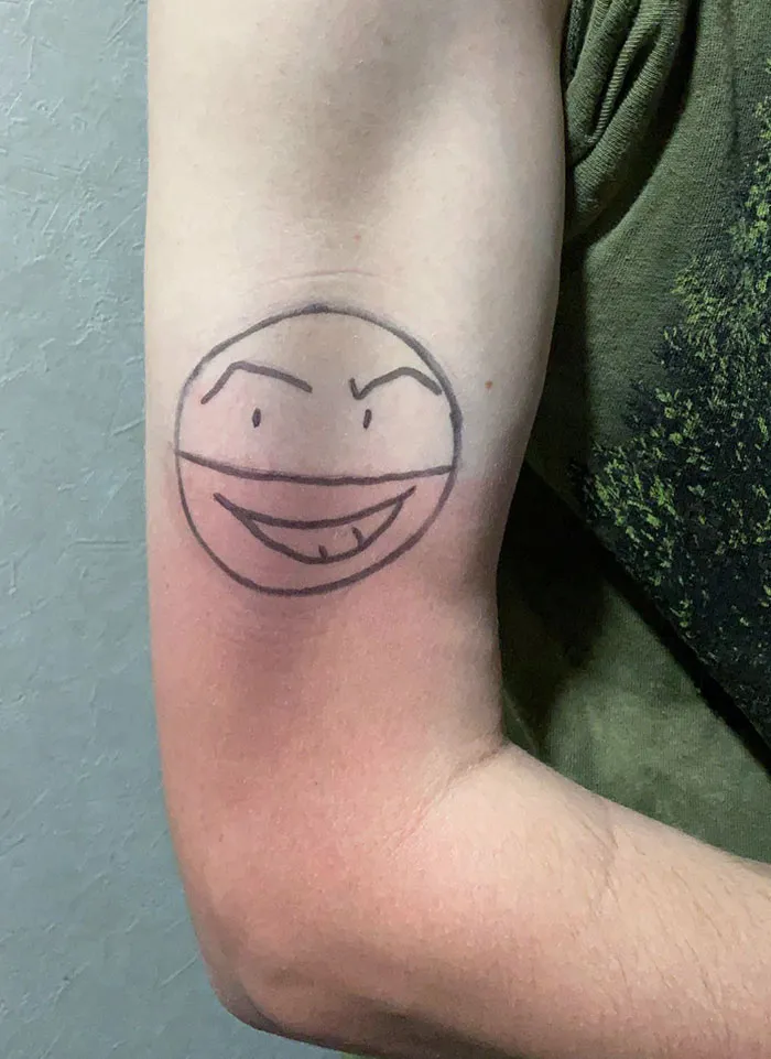 I Got Sunburn Yesterday