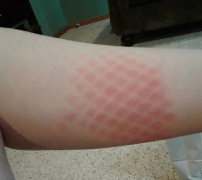 Las redes me convirtieron en un híbrido de humano y serpiente