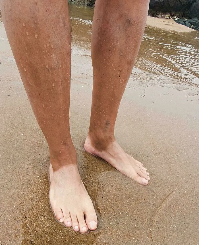 My Dad's White Feet And Tanned Legs. He Wears The Same Shoes Everyday