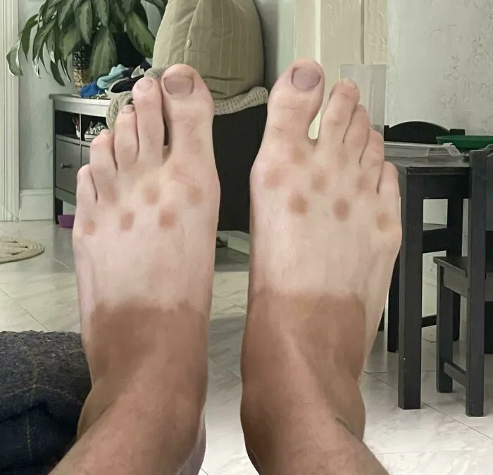 Mis bronceado de crocs