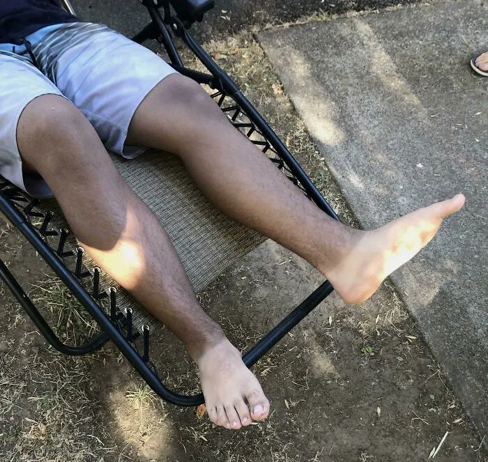 Tanned A Bit Too Much While Wearing Shoes. Kids Call Them My Chimp Feet