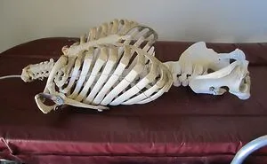 Only People With Rare Body Features Joined This Thread And Shared 35 Of Their Body Anomalies