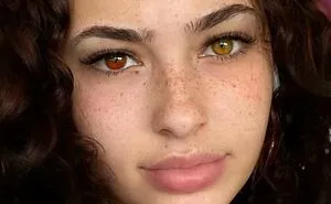 50 Photos Of Unique People That Show That Genetics Is Hard To Predict (New Pics)