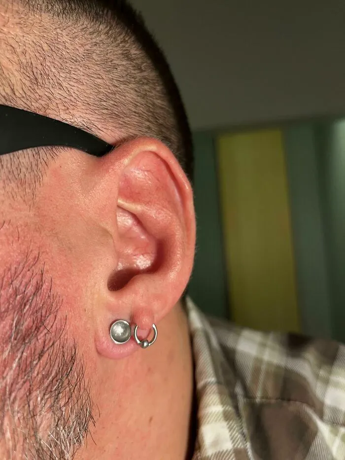 Nací con un poco de piel de más en la oreja, así que pensé que había que hacer algo