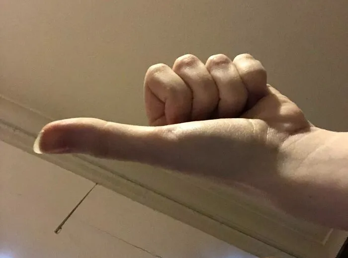 I Have Somewhat Long Thumbs