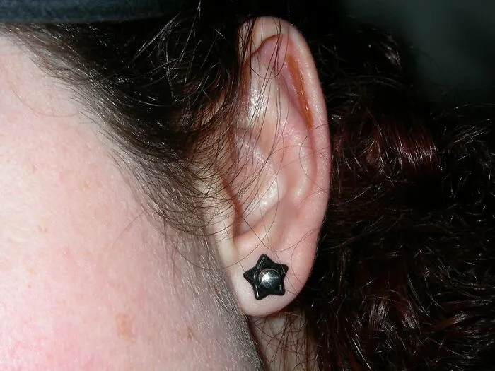 My Hearing Is Insane