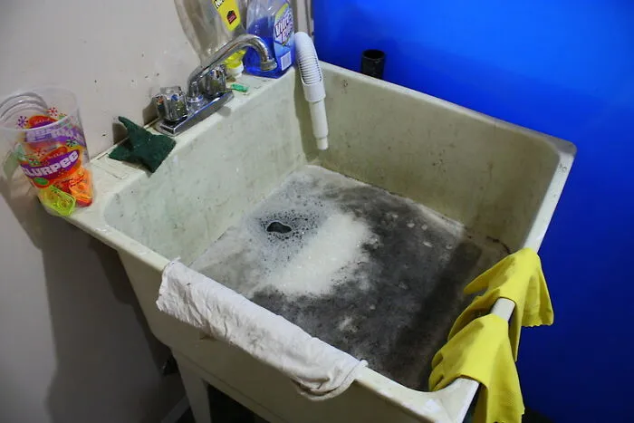 Maybe The Most Incredible Neglect Of Hygiene