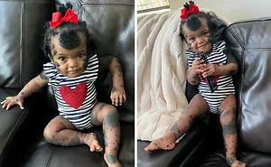 50 Photos Of Unique People That Show That Genetics Is Hard To Predict (New Pics)
