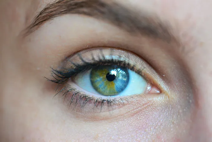Heterocromía sectorial. La gente siempre comenta mis ojos, así que pensé que debía publicar una foto