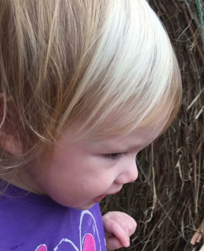 Her Birthmark Created Awesome Highlights