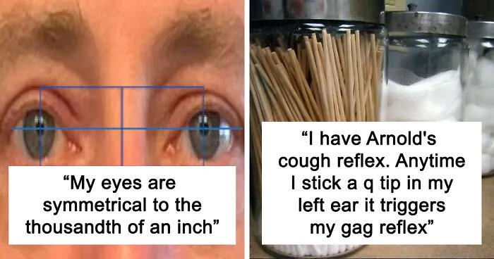 Only People With Rare Body Features Joined This Thread And Shared 35 Of Their Body Anomalies