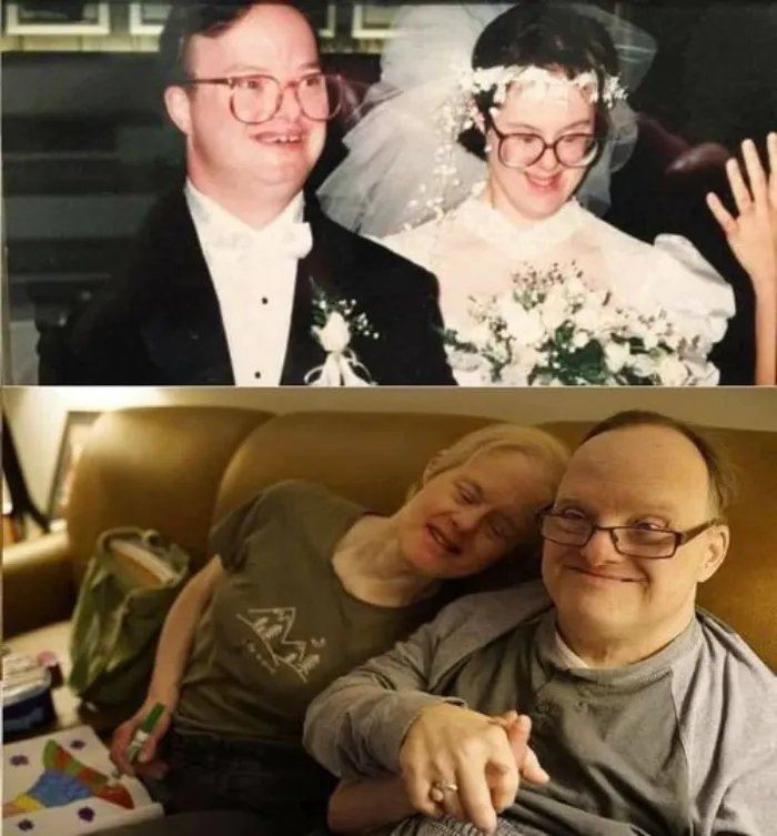 A Couple With Down Syndrome Who Were Told Not To Marry Still Proving Critics Wrong 25 Years Later!