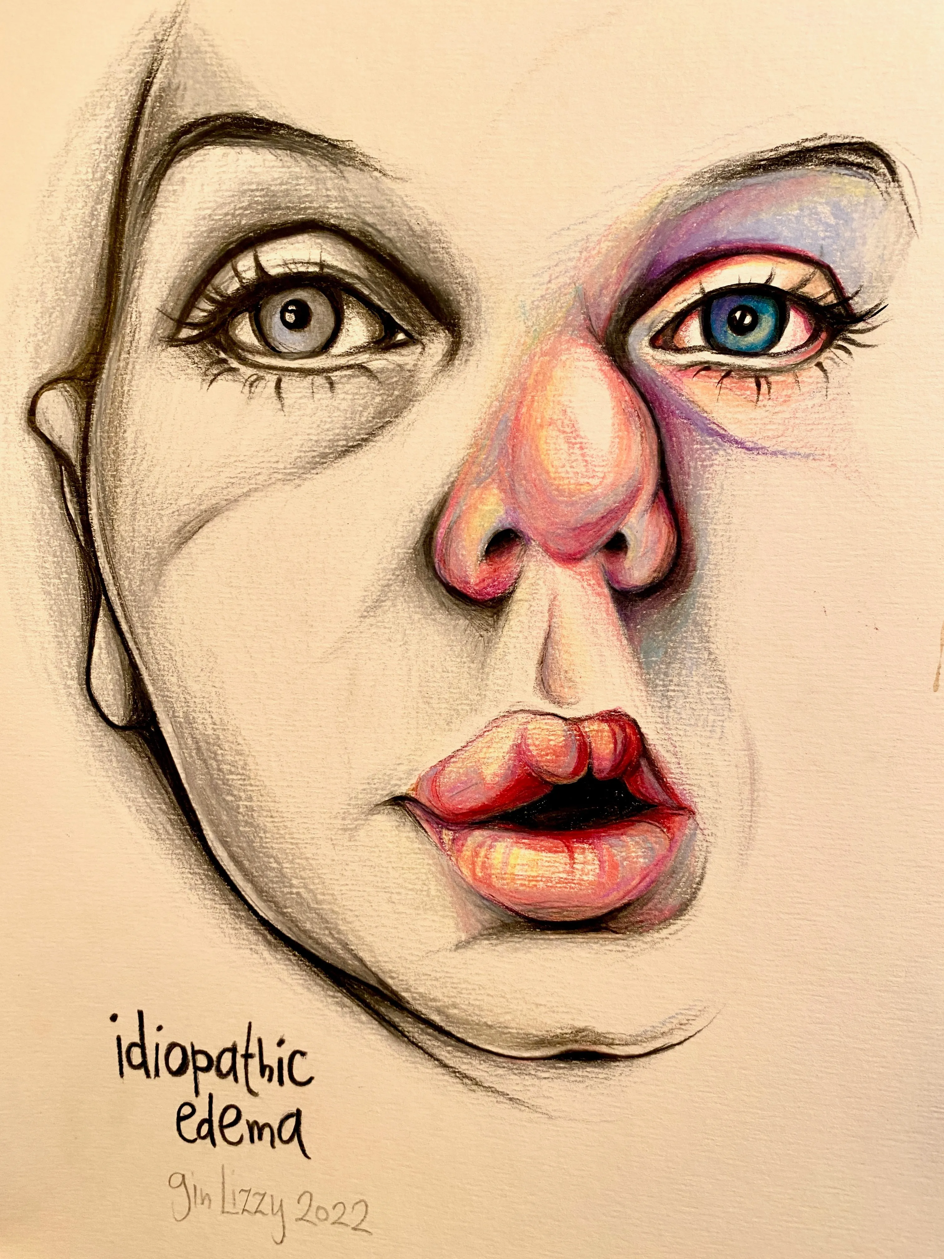 I Drew A Series Of Portraits Of My Friends' Self-Documented Injuries & Medical Issues