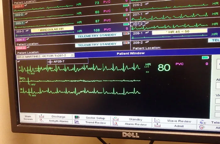 I Have An Eerily Low Heart Rate