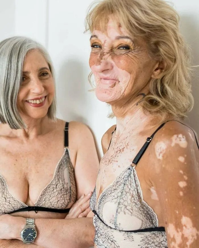 Its Amazing That A Lingerie Brand Shows All Types Of Bodies