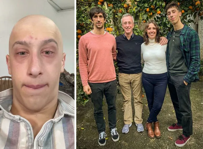 Me Suffering From Cancer Over The Spring vs. Me Happy And Healthy Spending Christmas With My Beautiful Family