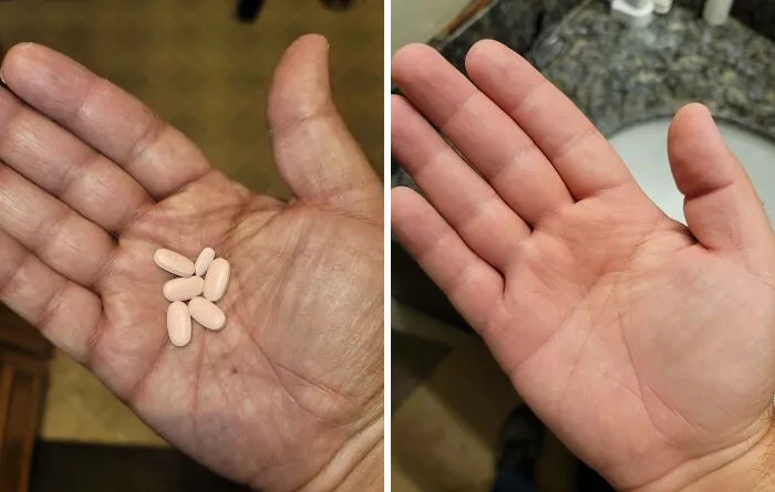My Skin While On Chemo Last Year vs. Now