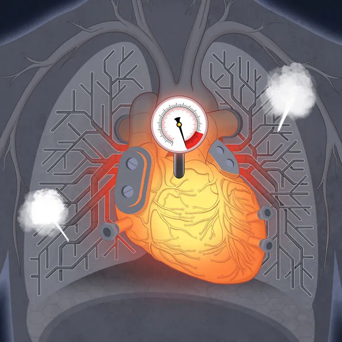 Hypertension