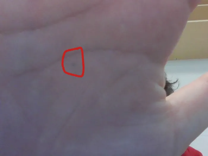 Accidentally Stabbed Myself With A Pencil In 5th Grade