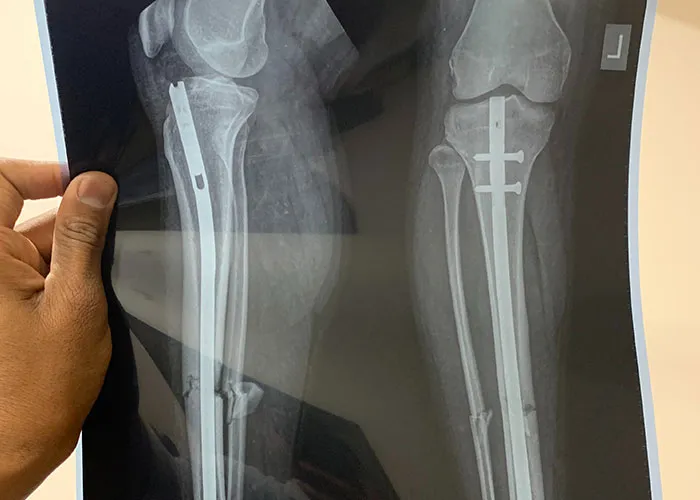 30 Of The Wildest "I Don't Think This Is Important, But-" Moments, As Shared By Doctors On This Online Thread