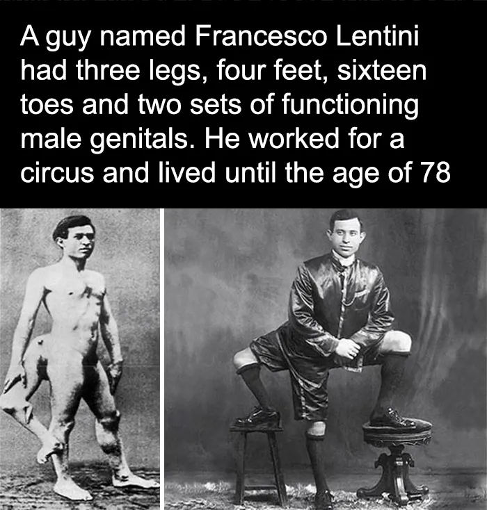 Triple the Limbs, Double the Story