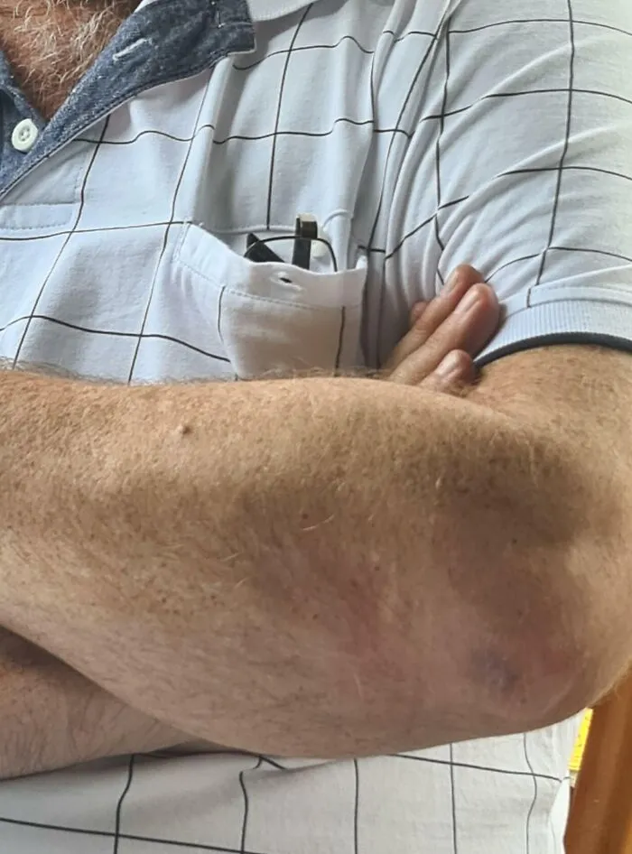 My Step Dad's Shirt Lines Up With His Glasses Inside The Pocket