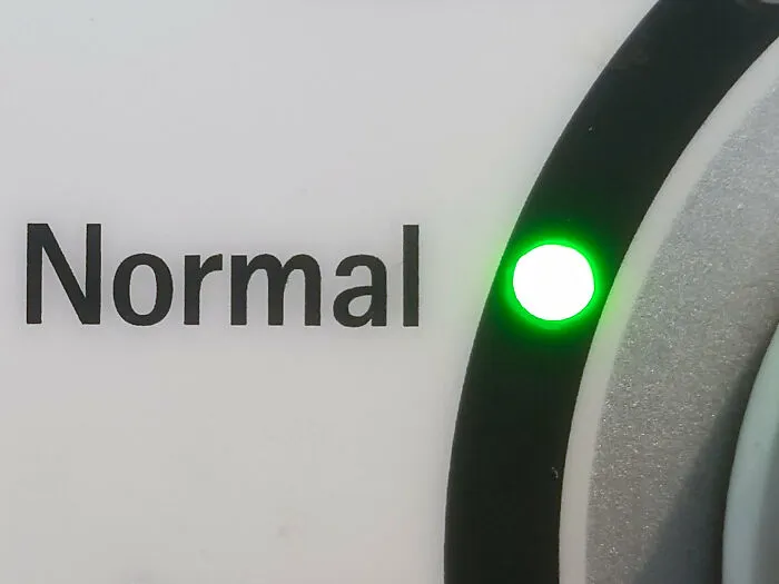 20 Personas que pensaban que algo era normal y al final descubrieron que no lo era