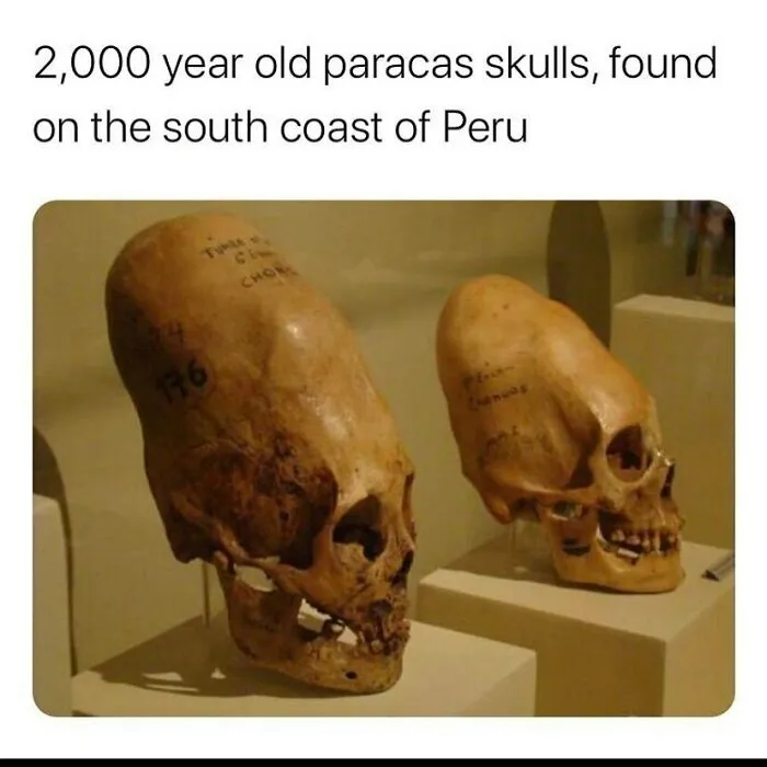 Two elongated 2,000-year-old Paracas skulls displayed on stands, showcasing creepy facts and mysterious history.