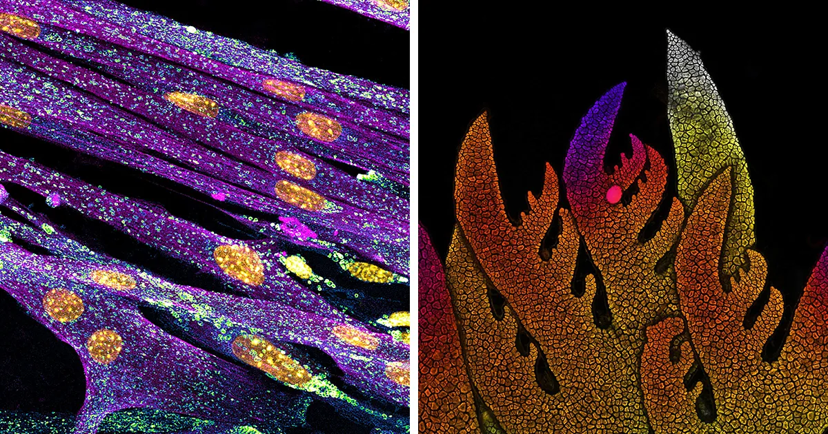 Las mejores 30 fotografías microscópicas del concurso Nikon Small World Photomicrography de 2022