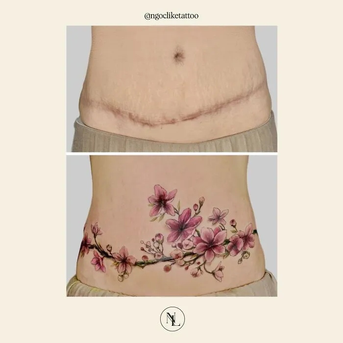 50 Times People Asked To Cover Up Their Scars, And This Tattoo Artist Nailed It (New Pics)