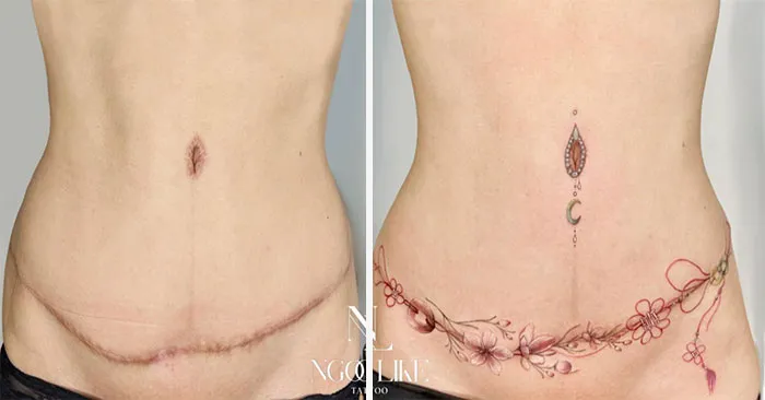 40 Personas que querían tapar sus cicatrices, y esta tatuadora lo consiguió (nuevas fotos)