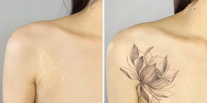 40 Personas que querían tapar sus cicatrices, y esta tatuadora lo consiguió (nuevas fotos)
